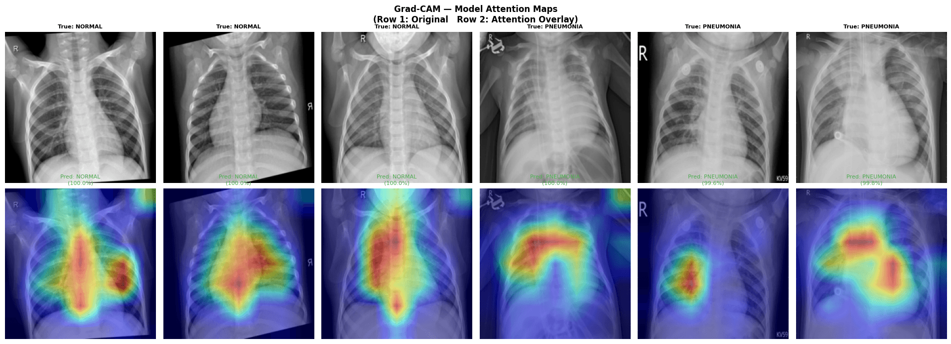 Model performance — confusion matrix, ROC curve, and Grad-CAM attention maps